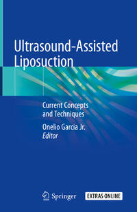 Vorderes Coverbild Ultrasound-Assisted Liposuction