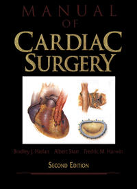 Vorderes Coverbild Manual of Cardiac Surgery