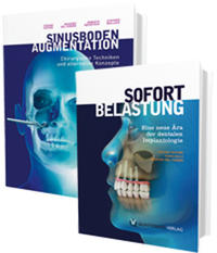 Vorderes Coverbild Sinusbodenaugmentation und Sofortbelastung