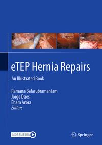 Vorderes Coverbild eTEP Hernia Repairs