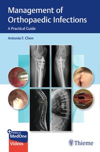 Vorderes Coverbild Management of Orthopaedic Infections