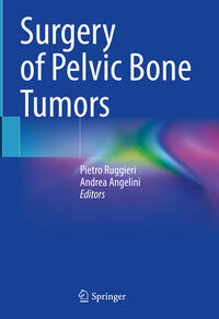 Vorderes Coverbild Surgery of Pelvic Bone Tumors