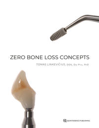 Vorderes Coverbild Zero Bone Loss Concepts