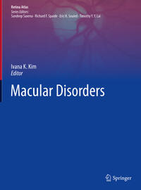 Vorderes Coverbild Macular Disorders