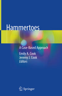 Vorderes Coverbild Hammertoes