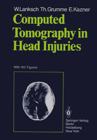 Vorderes Coverbild Computed Tomography in Head Injuries