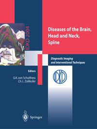 Vorderes Coverbild Diseases of the Brain, Head and Neck, Spine