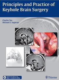 Vorderes Coverbild Principles and Practice of Keyhole Brain Surgery