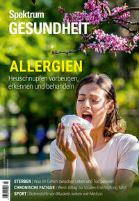 Vorderes Coverbild Spektrum Gesundheit - Allergien