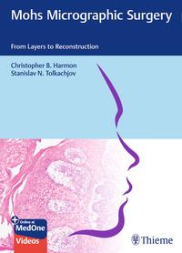 Vorderes Coverbild Mohs Micrographic Surgery: From Layers to Reconstruction