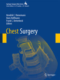 Vorderes Coverbild Chest Surgery