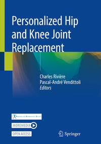Vorderes Coverbild Personalized Hip and Knee Joint Replacement