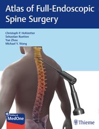 Vorderes Coverbild Atlas of Full-Endoscopic Spine Surgery