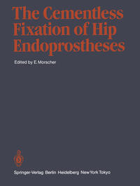 Vorderes Coverbild The Cementless Fixation of Hip Endoprostheses