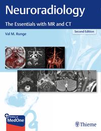 Vorderes Coverbild Neuroradiology