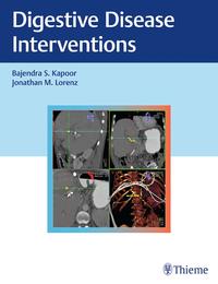 Vorderes Coverbild Digestive Disease Interventions