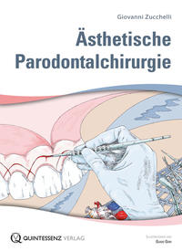 Vorderes Coverbild Ästhetische Parodontalchirurgie