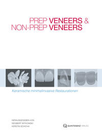 Vorderes Coverbild Prep Veneers und Non-Prep Veneers