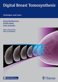 Vorderes Coverbild Digital Breast Tomosynthesis