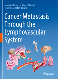 Vorderes Coverbild Cancer Metastasis Through the Lymphovascular System