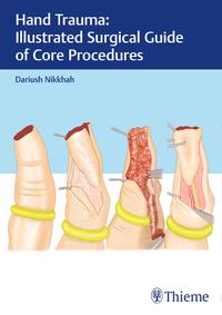 Vorderes Coverbild Hand Trauma: Illustrated Surgical Guide of Core Procedures