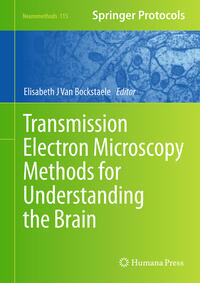 Vorderes Coverbild Transmission Electron Microscopy Methods for Understanding the Brain