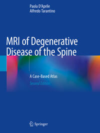 Vorderes Coverbild MRI of Degenerative Disease of the Spine