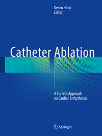 Vorderes Coverbild Catheter Ablation