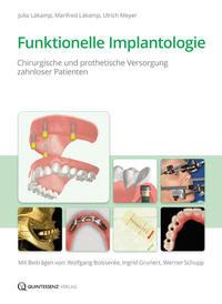 Vorderes Coverbild Funktionelle Implantologie