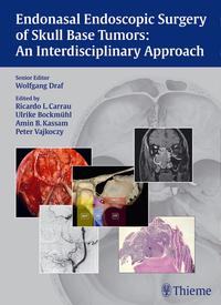 Vorderes Coverbild Endonasal Endoscopic Surgery of Skull Base Tumors: An Interdisciplinary Approach