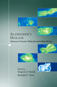 Vorderes Coverbild Alzheimer's Disease