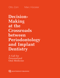 Vorderes Coverbild Decision-Making at the Crossroads between Periodontology and Implant Dentistry