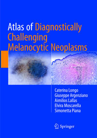 Vorderes Coverbild Atlas of Diagnostically Challenging Melanocytic Neoplasms