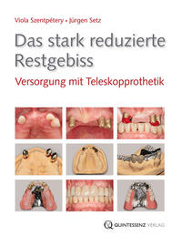 Vorderes Coverbild Das stark reduzierte Restgebiss