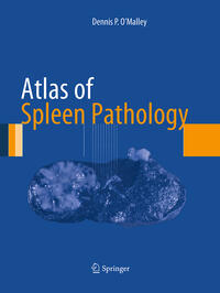 Vorderes Coverbild Atlas of Spleen Pathology