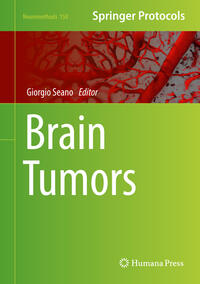 Vorderes Coverbild Brain Tumors