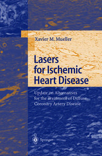 Vorderes Coverbild Lasers for Ischemic Heart Disease