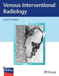 Vorderes Coverbild Venous Interventional Radiology