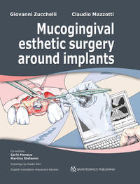 Vorderes Coverbild Mucogingival Esthetic Surgery around Implants