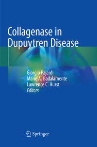 Vorderes Coverbild Collagenase in Dupuytren Disease