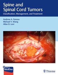 Vorderes Coverbild Spine and Spinal Cord Tumors