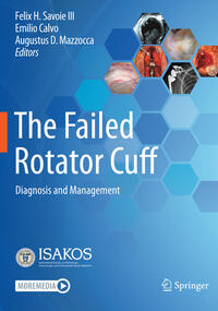 Vorderes Coverbild The Failed Rotator Cuff