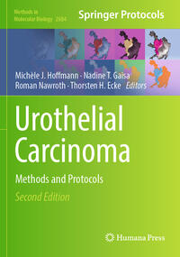 Vorderes Coverbild Urothelial Carcinoma