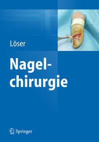 Vorderes Coverbild Nagelchirurgie
