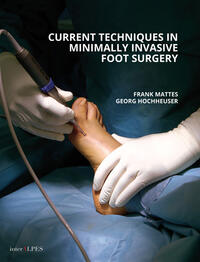Vorderes Coverbild Current Techniques in Minimally Invasive Foot Surgery