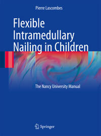 Vorderes Coverbild Flexible Intramedullary Nailing in Children