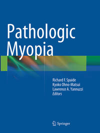 Vorderes Coverbild Pathologic Myopia