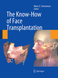 Vorderes Coverbild The Know-How of Face Transplantation