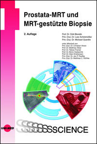 Vorderes Coverbild Prostata-MRT und MRT-gestützte Biopsie