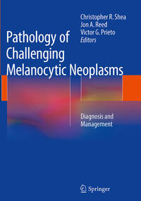 Vorderes Coverbild Pathology of Challenging Melanocytic Neoplasms
